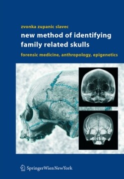 New Method of Identifying Family Related Skulls