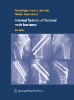 Internal fixation of femoral neck fractures