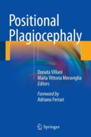 Positional Plagiocephaly