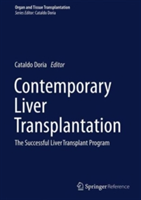 Contemporary Liver Transplantation