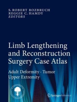 Limb Lengthening and Reconstruction Surgery Case Atlas, m. 1 Buch, m. 1 E-Book