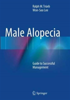 Male Alopecia