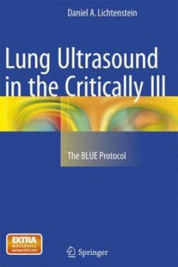 Lung Ultrasound in the Critically Ill