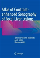 Atlas of Contrast-enhanced Sonography of Focal Liver Lesions