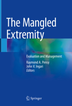 Mangled Extremity