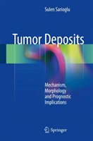 Tumor Deposits