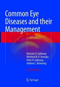 Common Eye Diseases and their Management