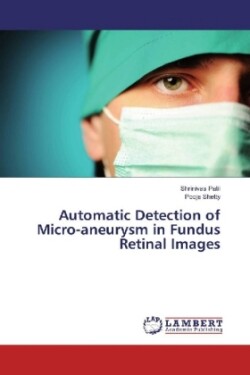 Automatic Detection of Micro-aneurysm in Fundus Retinal Images