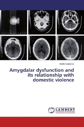 Amygdalar dysfunction and its relationship with domestic violence