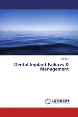 Dental Implant Failures & Management