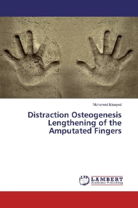 Distraction Osteogenesis Lengthening of the Amputated Fingers