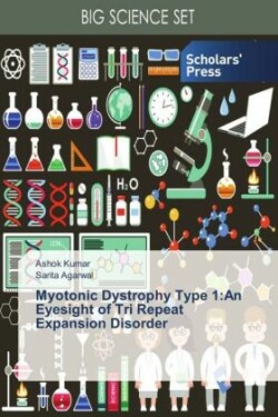 Myotonic Dystrophy Type 1:An Eyesight of Tri Repeat Expansion Disorder
