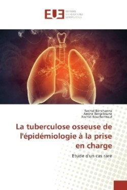 La tuberculose osseuse de l'épidémiologie à la prise en charge