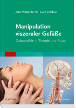 Manipulation viszeraler Gefäße