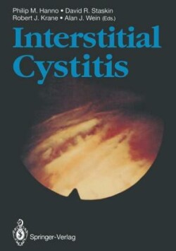 Interstitial Cystitis