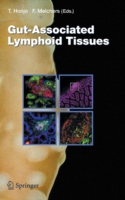 Gut-Associated Lymphoid Tissues