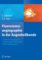 Fluoreszenzangiographie in der Augenheilkunde