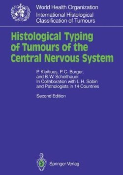 Histological Typing of Tumours of the Central Nervous System