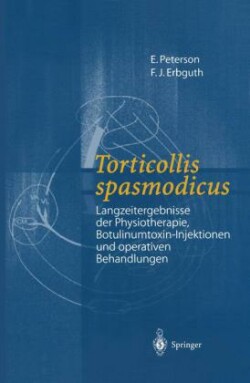 Torticollis spasmodicus