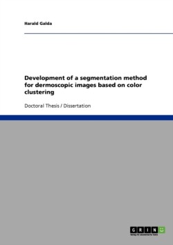 Development of a segmentation method for dermoscopic images based on color clustering
