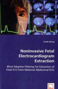 Noninvasive Fetal Electrocardiogram Extraction