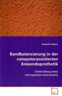 Bandbalancierung in der computerassistierten Knieendoprothetik