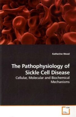 Pathophysiology of Sickle Cell Disease