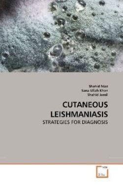 Cutaneous Leishmaniasis