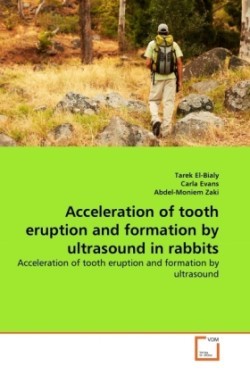 Acceleration of tooth eruption and formation by ultrasound in rabbits