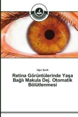 Retina Görüntülerinde Yaşa Bağlı Makula Dej. Otomatik Bölütlenmesi