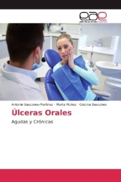 Úlceras Orales