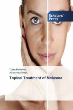 Topical Treatment of Melasma