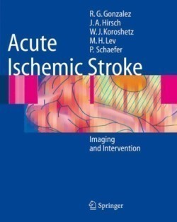 Acute Ischemic Stroke