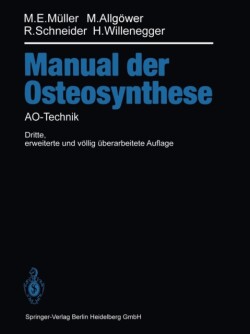 Manual der OSTEOSYNTHESE