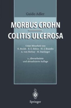 Morbus Crohn - Colitis ulcerosa