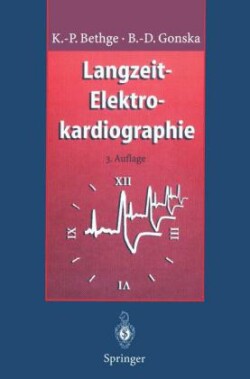 Langzeit-Elektrokardiographie