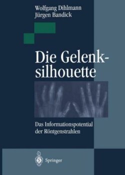 Die Gelenksilhouette