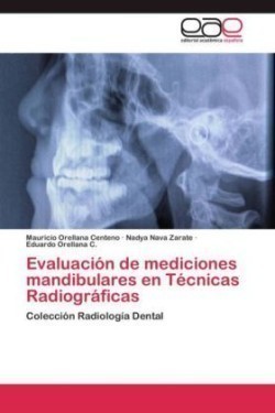 Evaluación de mediciones mandibulares en Técnicas Radiográficas