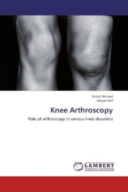 Knee Arthroscopy