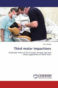 Third molar impactions