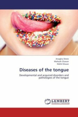 Diseases of the tongue