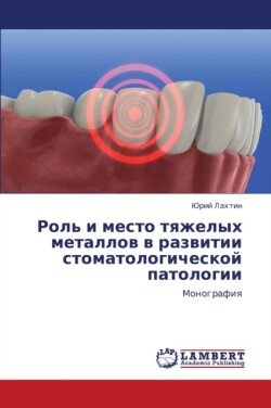 Rol' I Mesto Tyazhelykh Metallov V Razvitii Stomatologicheskoy Patologii