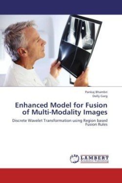 Enhanced Model for Fusion of Multi-Modality Images