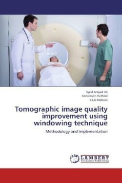 Tomographic image quality improvement using windowing technique