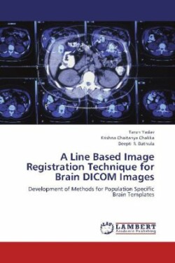Line Based Image Registration Technique for Brain Dicom Images