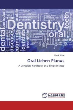 Oral Lichen Planus