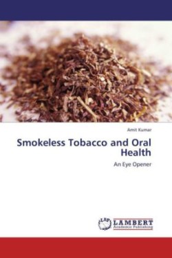 Smokeless Tobacco and Oral Health