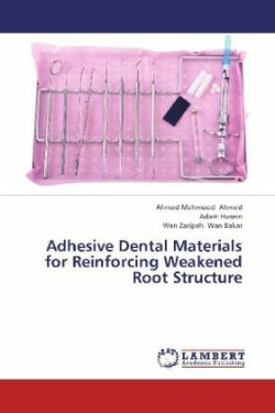 Adhesive Dental Materials for Reinforcing Weakened Root Structure