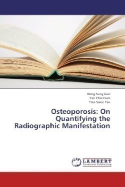 Osteoporosis