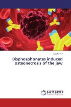 Bisphosphonates induced osteonecrosis of the jaw